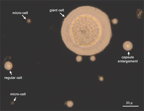 Hyderabad Scientists Uncover How a Deadly Fungus Creates Giant ‘Titan Cells’ to Survive